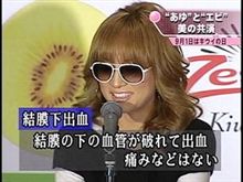 いよいよです！