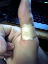 昨日仕事中ありえない所指きった