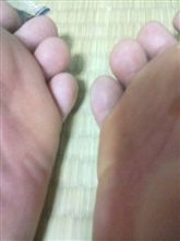 ちょっと右のほうが大きいんです･･･