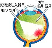 入院確定 入院確定