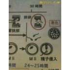 知恵熱…（；&#180;Д｀）