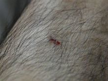 豆腐のかどにすねをぶつけてみるｗ