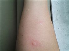 何の鼻炎なのか検査したら