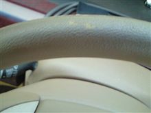 禿げ始めました