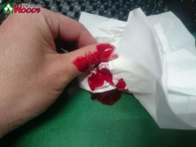うわぁぁぁぁぁぁ 手がぁぁぁぁぁ ウッドミッツのブログ ウッドミッツ みんカラ うわぁぁぁぁぁぁ 手がぁぁぁぁぁ ウッドミッツのブログ ウッドミッツ みんカラ