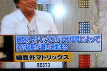 →の多い町。指が再生するぅ？？、凄ぇぇぇ。