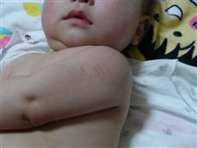 ４ヶ月健診