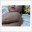 ４ヶ月健診