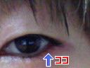 アイタタ（＞＜）