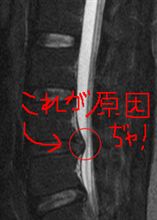 無茶したわけではないのですが････