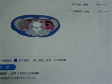 健康診断その②