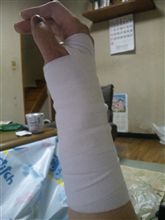 今の右手 今の右手