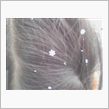 雪