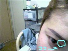 仕事でケガをした～！？