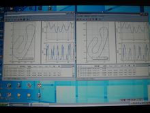 先日のTC1000復習