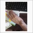 注射２回目です