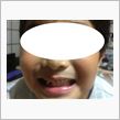 子どもの歯…