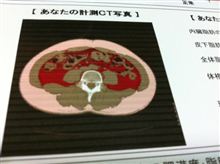 CT Scan