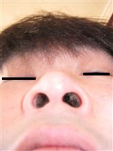 カートの敵はブログで討つ！！