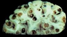 生ものは食べない方が良いと思います。（グロイから注意）！！