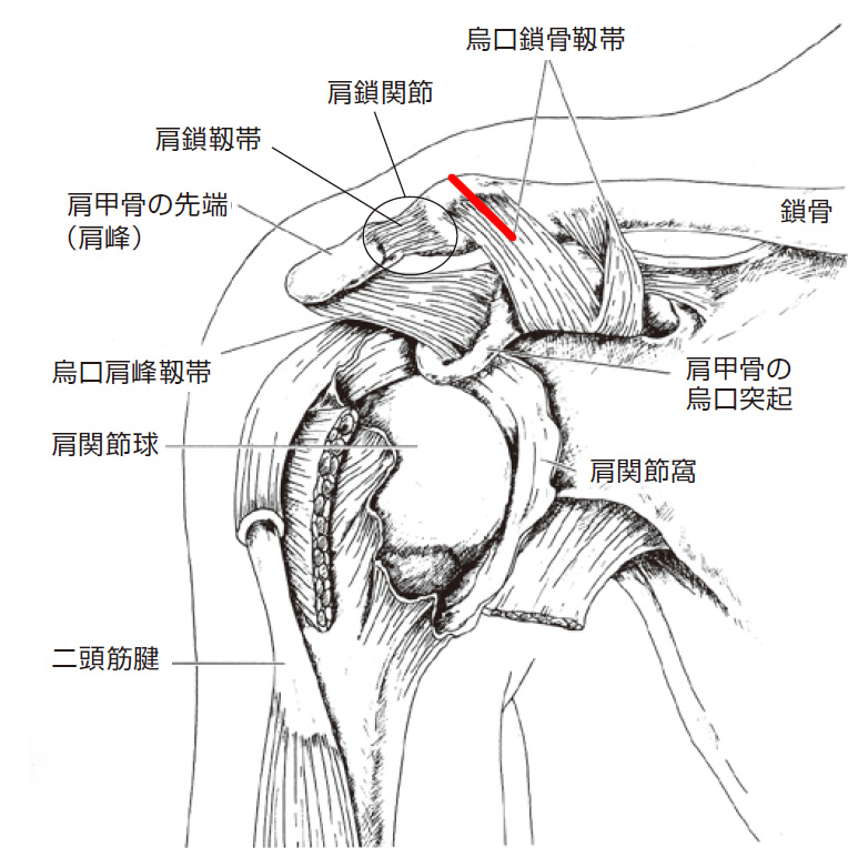 鎖骨骨折経過 スペc汁のブログ スペc汁の備忘録 みんカラ 鎖骨骨折経過 スペc汁のブログ スペc汁の備忘録 みんカラ