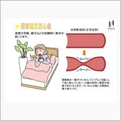狭心症？