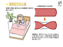 狭心症？