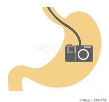 胃カメラ　(p_-)