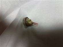 歯が折れました