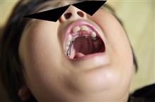 矯正歯科（汗）。