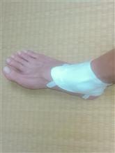 捻挫？です