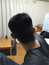 発毛