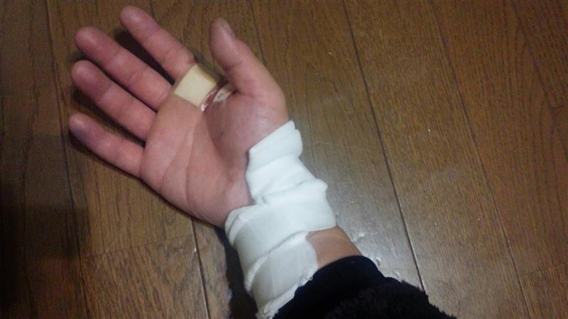 猫に噛まれて手に穴空いた D あきらっちょ ちぇけらっちょ 艸 のブログ 日々自分を磨いています キモ みんカラ