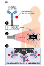 近赤外線でがん細胞が１日で消滅、転移したがんも治す