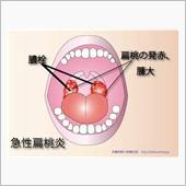 レブパ…断念します…ちーん