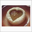 ダムカレー( *^3^)ﾉ