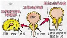 無常な日常(老人学2・キレが悪い!) 無常な日常(老人学2・キレが悪い!)