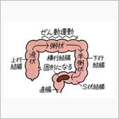 【ビョーキネタ―】過敏性腸症 ...