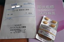 帯状疱疹