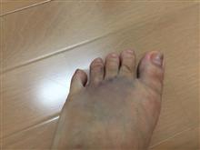 風邪からは復活(グロ注意)