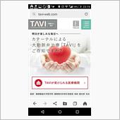 TAVI