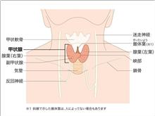 甲状腺がん「被曝と関連なし」 甲状腺がん「被曝と関連なし」