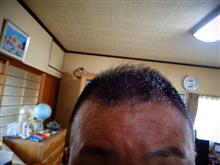 お見苦しい写真ですが