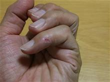 ここまで回復すりゃぁ