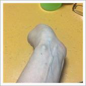 右の手首には無いんですが、ふ ...