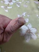 まさかまさかの･･･