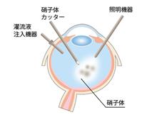 眼は大事！
