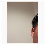 髪の毛が伸びるのが人より早い ...