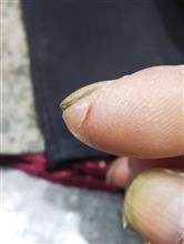 ヒリヒリするなと思ったら・・・。