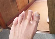 足の指が・・・。